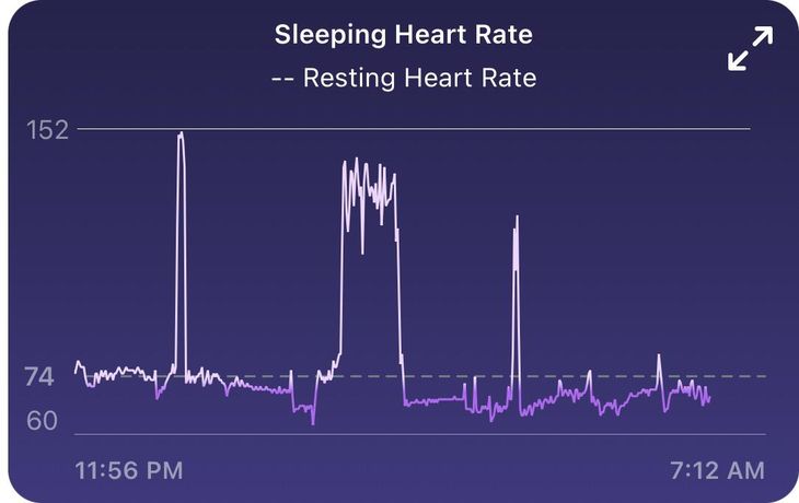 sudden spike in heart rate while sleeping analysis on dashboard